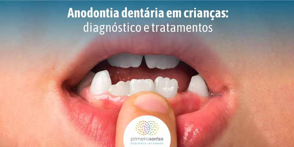 Estabilização protetora  Preciso segurar meu filho na consulta? – Clinica  Primeiro Sorriso Pediatria Integrada