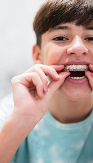 teenager-boy-wear-simulator-orthodontic-silicone-invisible-leveling-braces-teeth-dental-concept-orthodontics